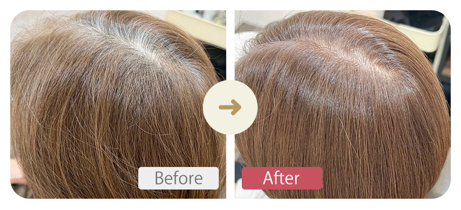 ビフォーアフター